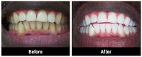 Cosmetic Dentist Glasgow 380714 Image 2